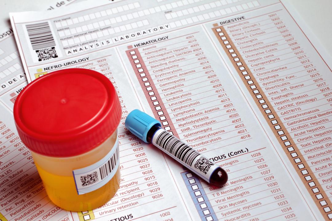 Blood and urine samples ready for lab—explore organized, reliable care with the best STD testing Houston providers.