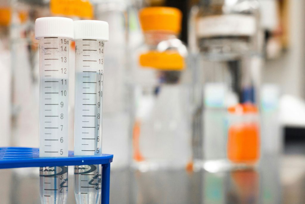 Sterile laboratory setting for reliable same day STD test Houston results.