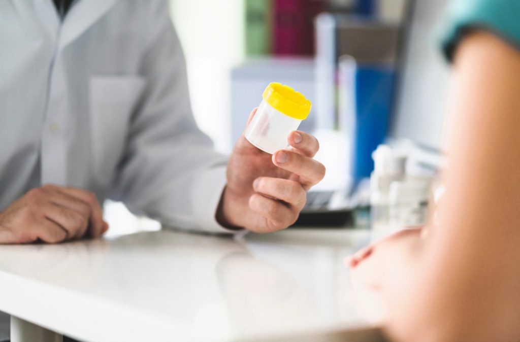 Clinician presents sterile urine specimen for testing; fast, confidential diagnostics at best std testing houston clinic.