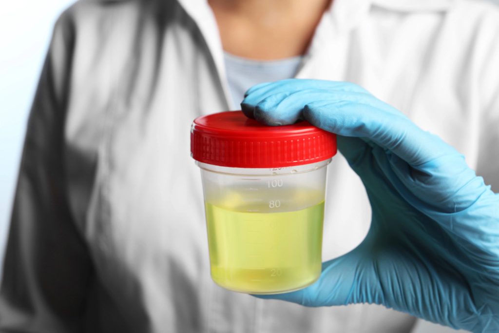 Gloved clinician holds labeled urine specimen for diagnostics; fast, discreet std testing houston at certified lab.