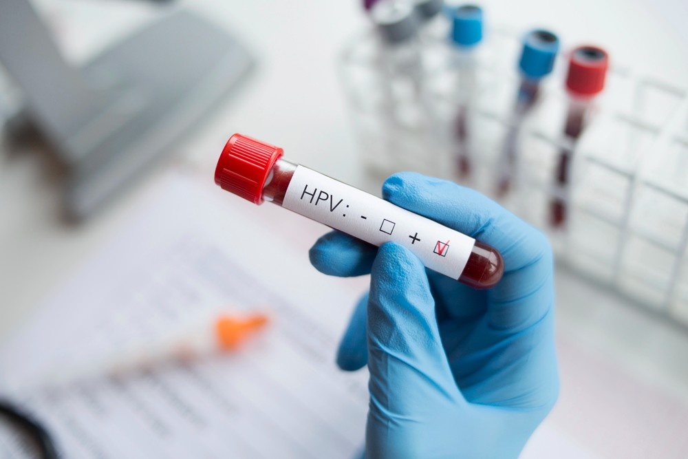 Gloved hand holding HPV-positive blood test tube in lab — same day std test houston, accurate diagnostics and screening