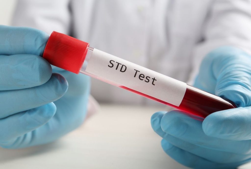 Gloved hands holding STD Test blood tube in lab, offering affordable std testing houston with fast, confidential results