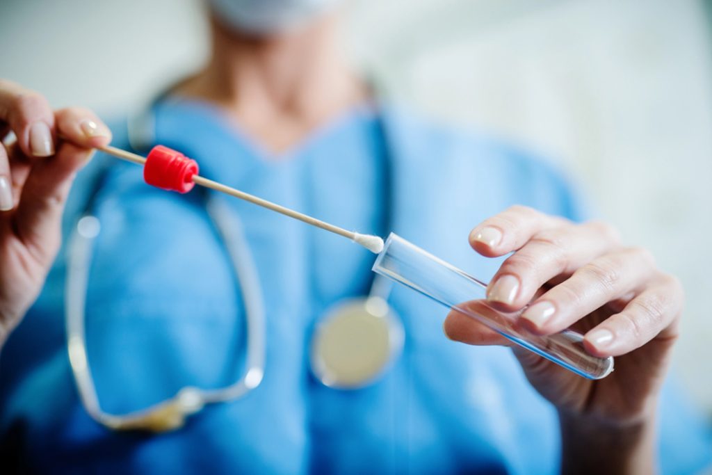 Healthcare professional collects swab for lab diagnostics and screening; fast, accurate services with cheap std testing houston.