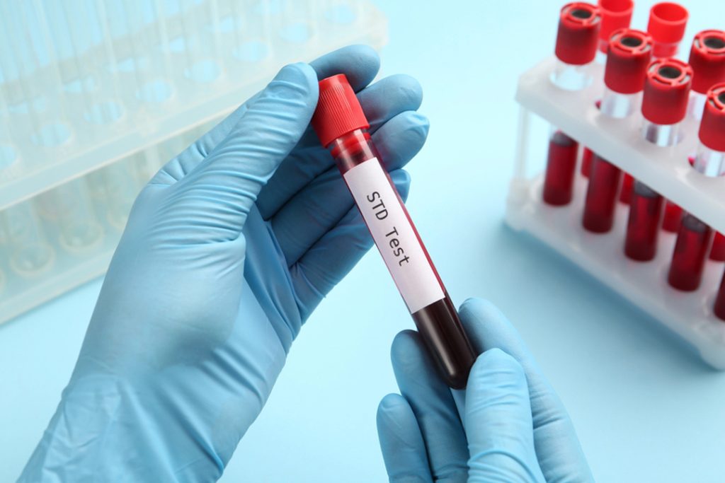 Gloved hands holding blood vial labeled STD Test in lab, promoting same day std test houston for fast, confidential screening