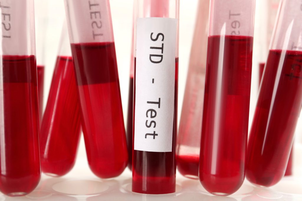 Rack of blood test vials ready for screening; find the best STD testing Houston clinic for fast, discreet results.