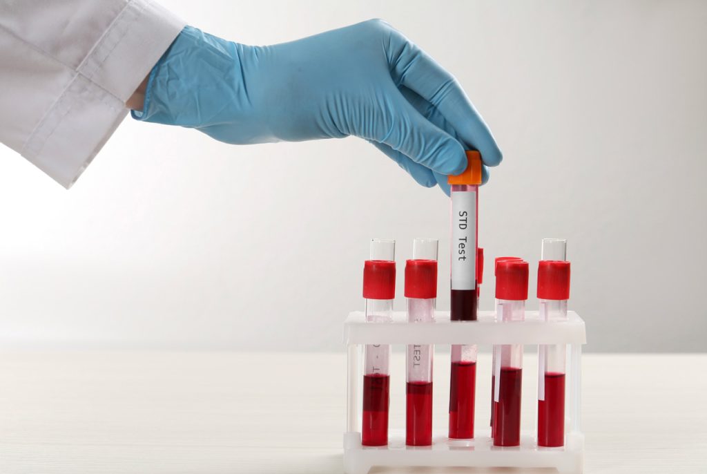 Lab technician performing confidential blood work for the best STD testing Houston offers, ensuring accurate results.
