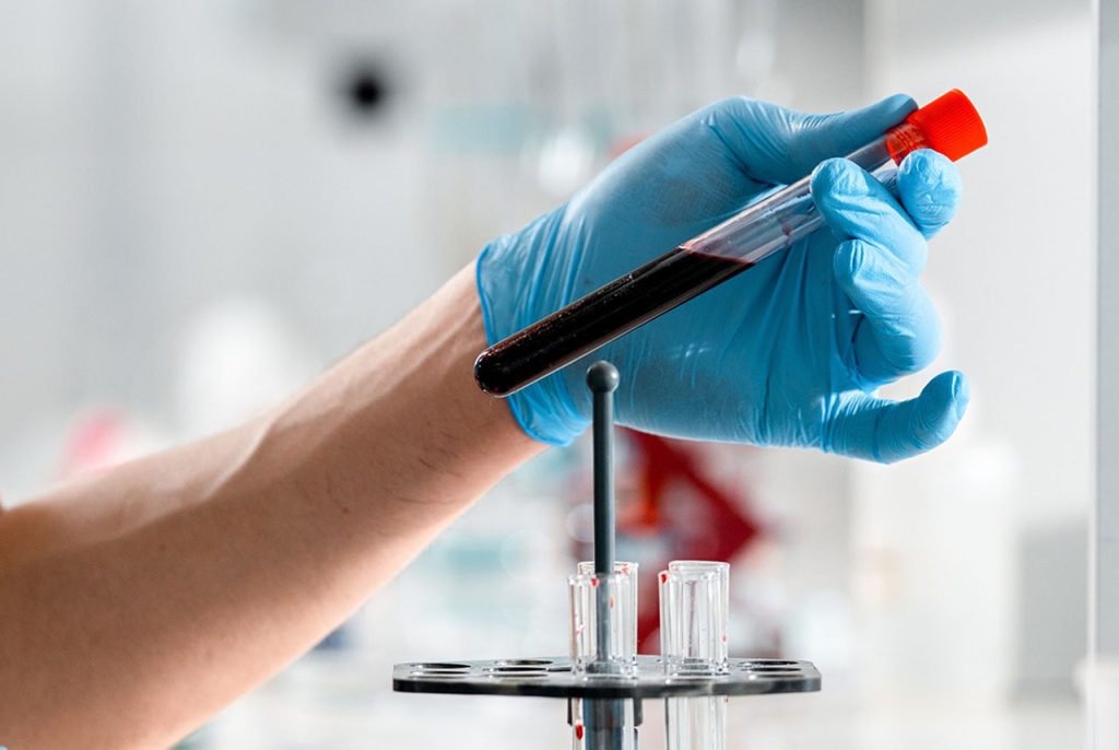 Medical professional providing STD treatment Houston by examining a blood sample test tube in a clinical laboratory.