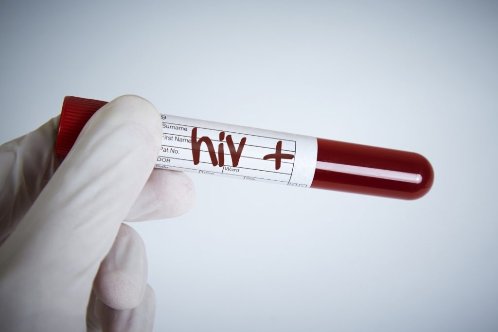 Confidential HIV screening services at a professional clinic providing affordable STD testing Houston city wide.